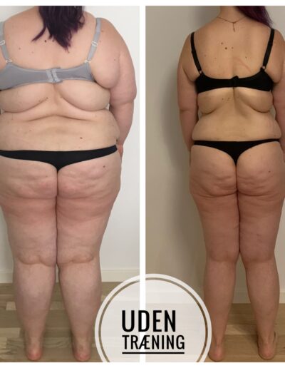 Vægttab transformation af Sundmedhelle.dk